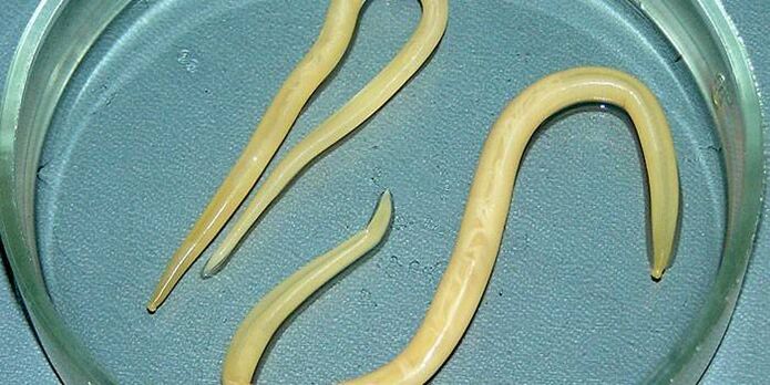 Cacing gelang manusia dalam hidangan Petri - berparasit pada dinding usus kecil