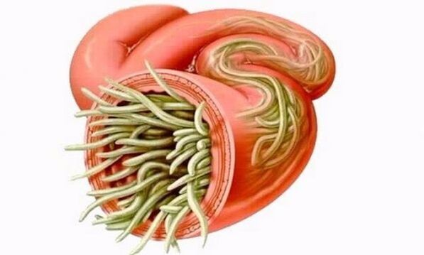 cacing dalam usus manusia