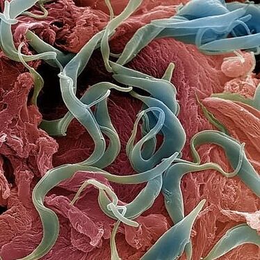 Pelbagai parasit yang hidup dalam tubuh manusia
