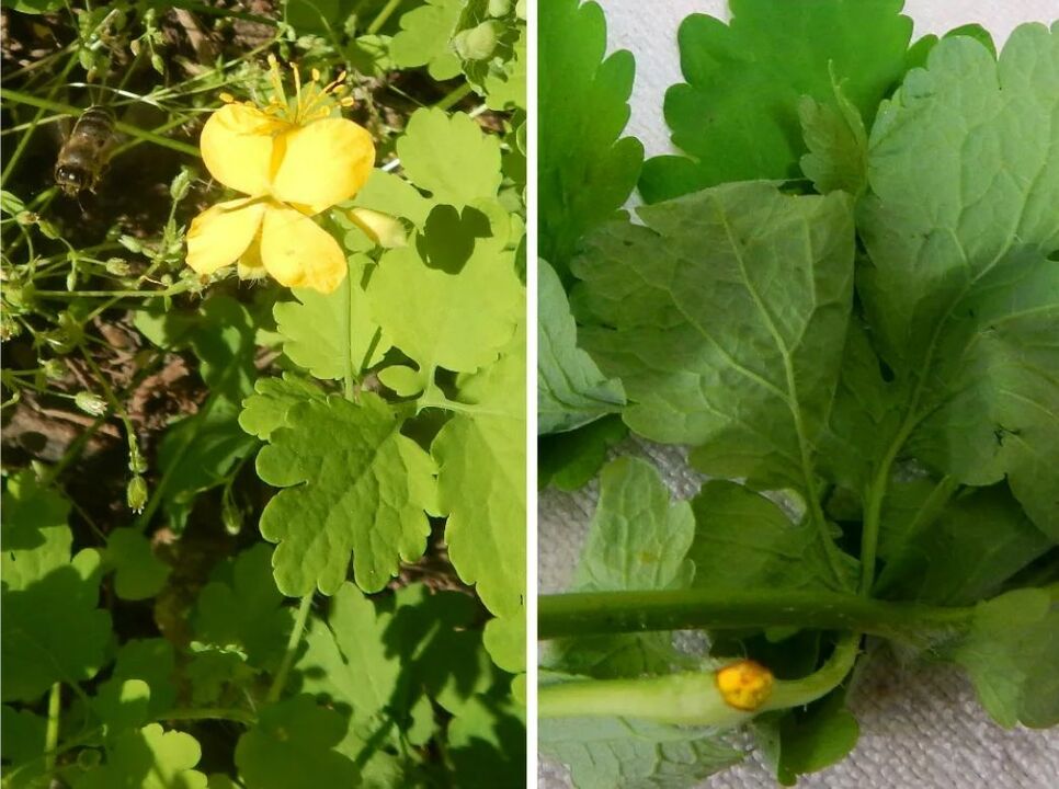 celandine terhadap parasit