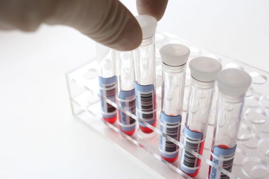 diagnosis parasit dalam badan